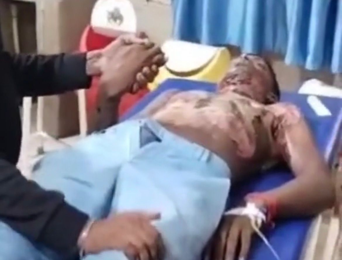 हाईटेंशन लाइन की चपेट में आया किशोर, हालत गंभीर