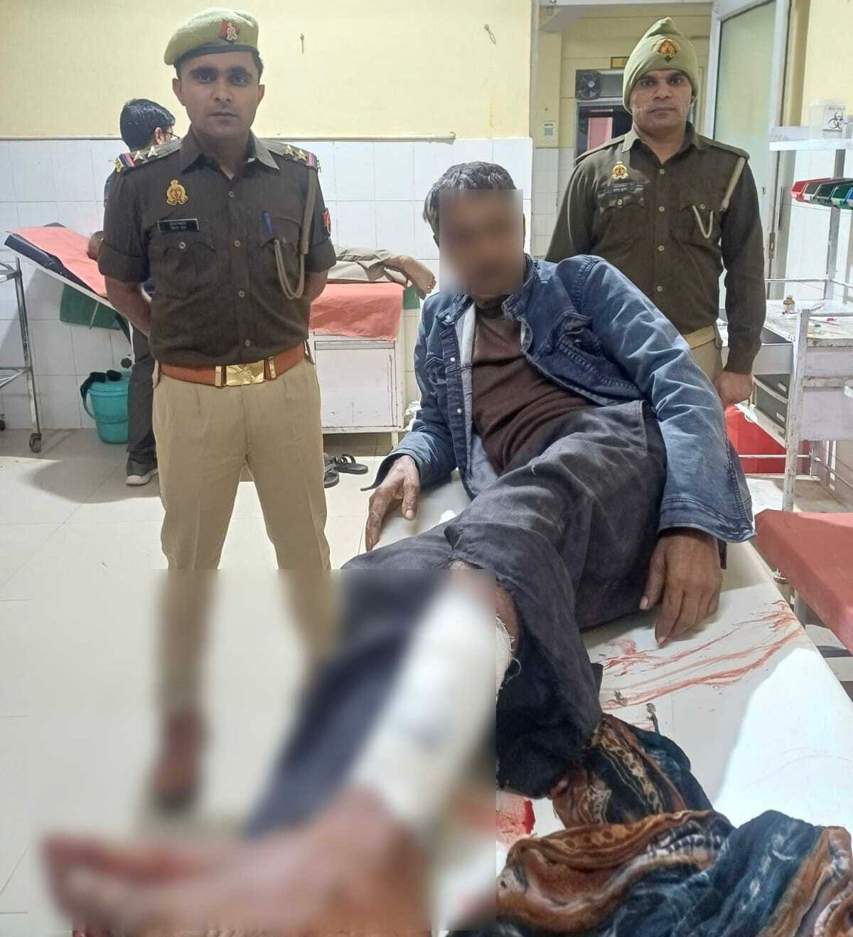 पुलिस ने पॉक्सो का फरार आरोपी मोहनलाल गोली लगने के बाद पकड़ा, मुठभेड़ में घायल 