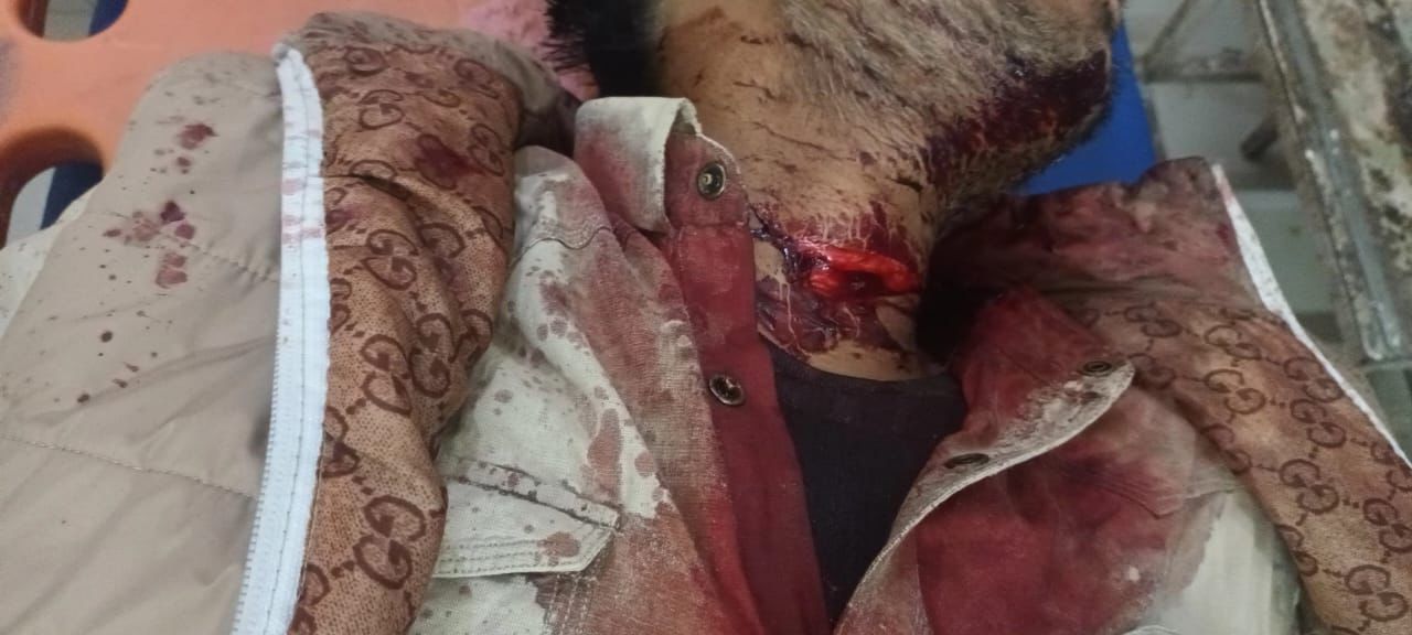 युवक ने ब्लेड से काटी गर्दन, अस्पताल में भर्ती