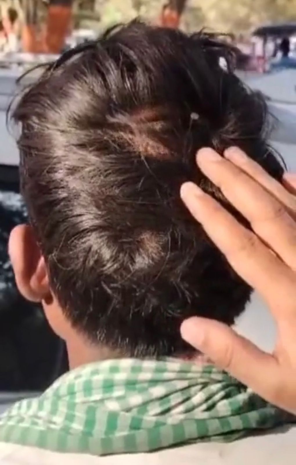 युवक ने परिजनों पर कील ठोंकने का लगाया आरोप ! कार्यवाही की मांग  