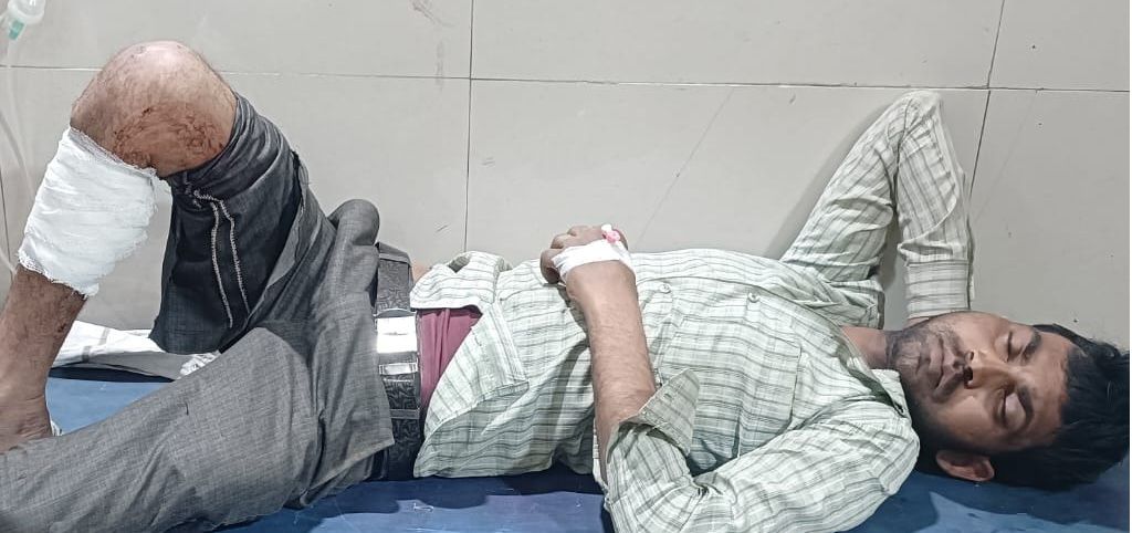 मुठभेड़ में दुष्कर्म का आरोपी गिरफ्तार, पैर में लगी गोली