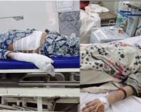 मां-बेटी संदिग्ध परिस्थितियों में झुलसीं, हालत गंभीर