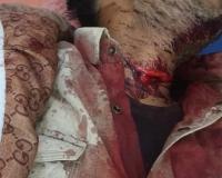 युवक ने ब्लेड से काटी गर्दन, अस्पताल में भर्ती