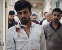 पुरानी रंजिश में युवक को मारी गोली, हालत स्थिर