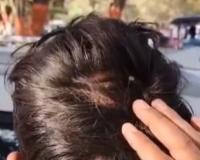 युवक ने परिजनों पर कील ठोंकने का लगाया आरोप ! कार्यवाही की मांग  