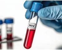 शादी रद्द होने के बाद एचआईवी संक्रमित व्यक्ति ने महिला को अपने खून की सूई लगा दी